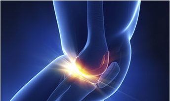 干细胞治疗膝骨关节炎疾病